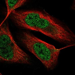 ODZ3 Antibody, Novus Biologicals 25 &mu;L, Unlabeled:Antibodies, Polyclonal